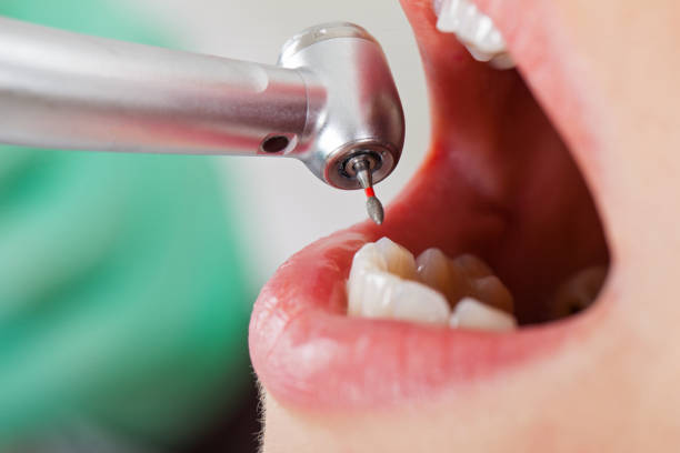Best Orthodontic Emergency Dentist in Meyers, CA